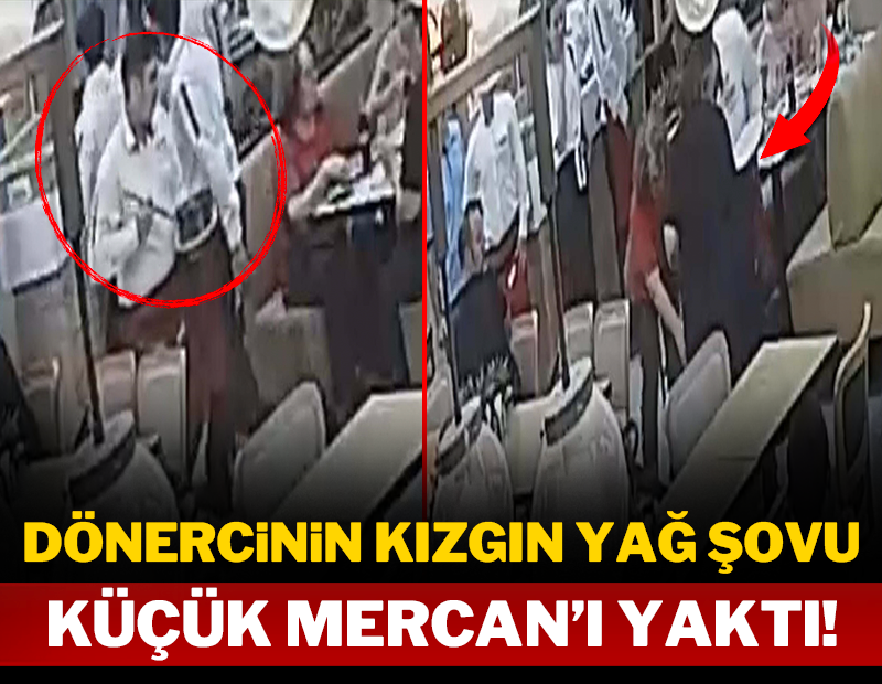 Dönercinin kızgın yağ şovu küçük Mercan'ı yaktı!