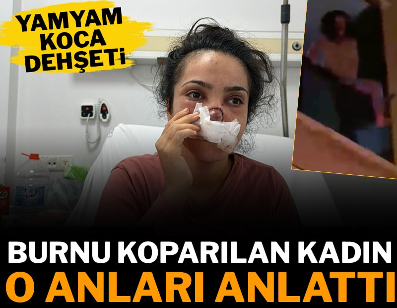 Manisa'da 'yamyam' koca dehşeti! Burnu koparılan kadın o anları anlattı