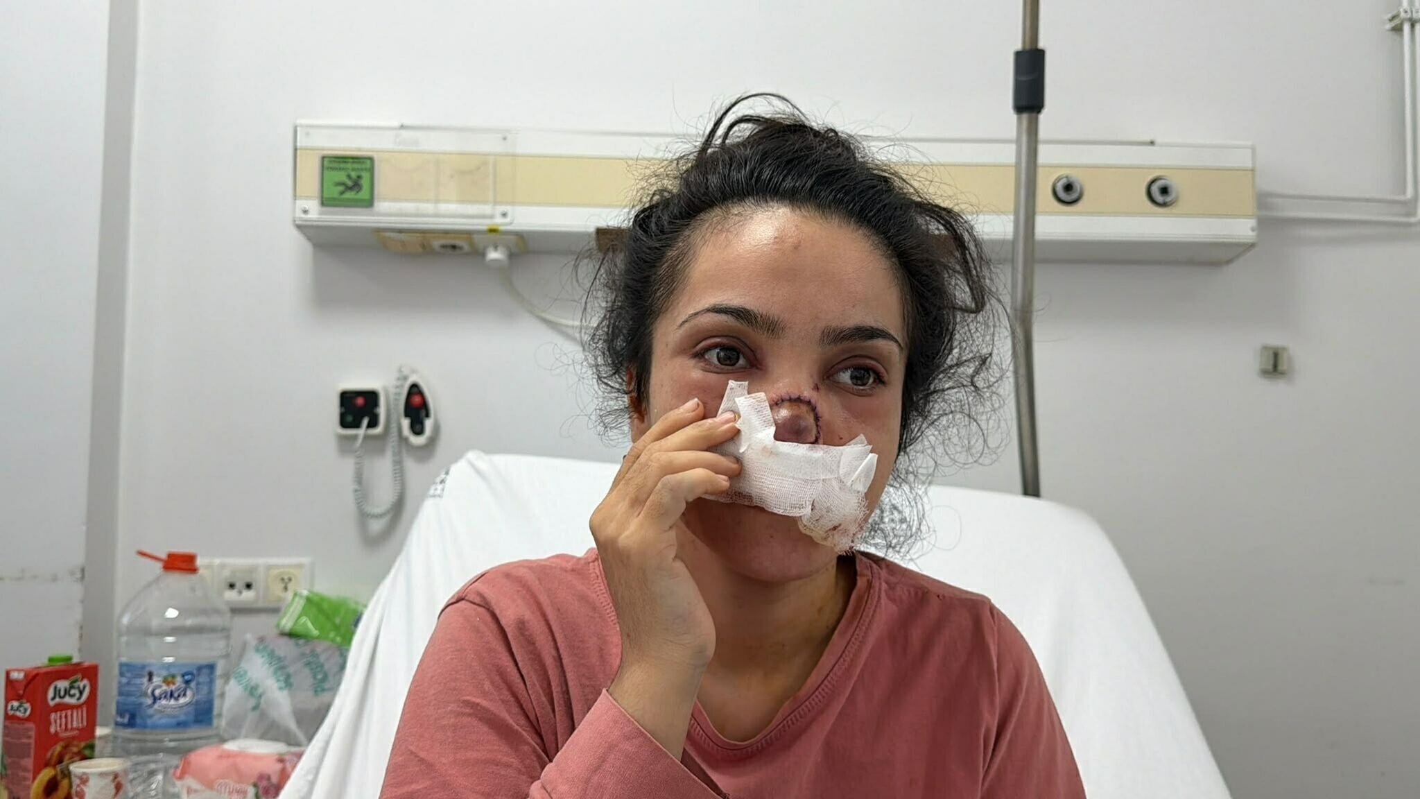 Manisa'da yamyamlık dehşeti! Burnu koparılan kadın o anları anlattı