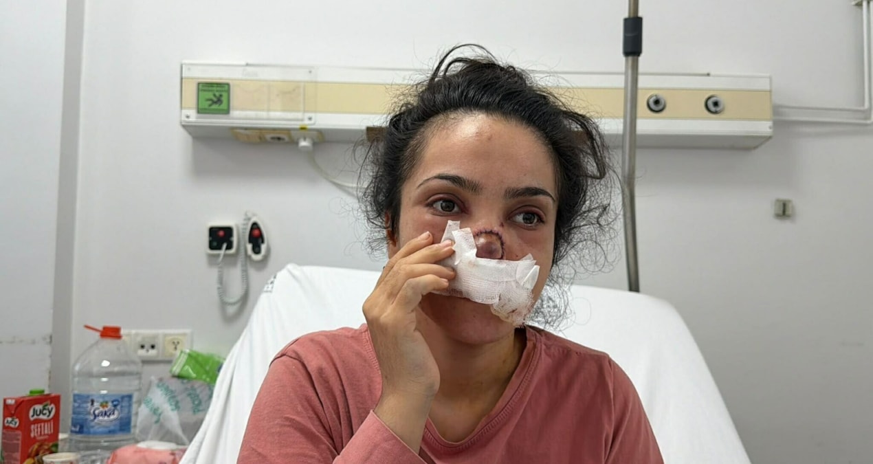 Manisa'da 'yamyam' koca dehşeti! Burnu koparılan kadın o anları anlattı - Sözcü Gazetesi