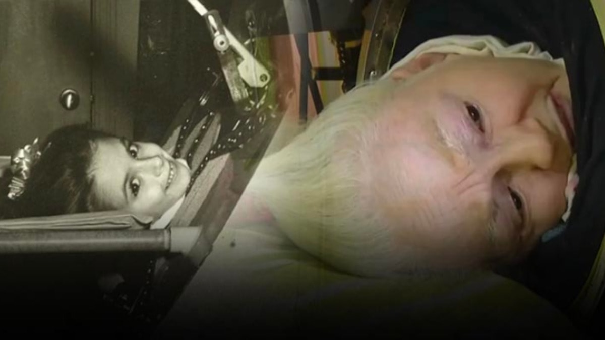 68 yıl 'Demir Akciğer' ile yaşadı, ölümü kahretti! Arıza hayatına mal oldu