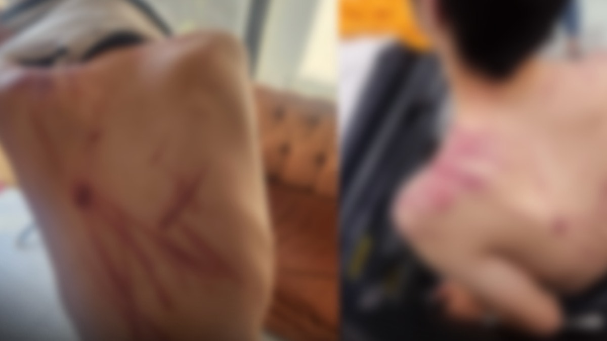 Valilik hafif yaralandı dedi: Rehabilitasyon merkezinde korkunç işkence
