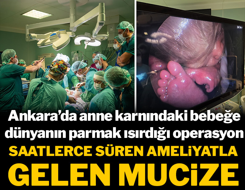 Ankara'da anne karnındaki bebeğe dünyanın parmak ısırdığı operasyon! Saatlerce süren ameliyatla gelen mucize