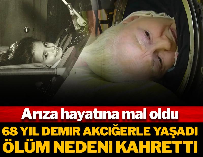 68 yıl 'Demir Akciğer' ile yaşadı, ölümü kahretti! Arıza hayatına mal oldu