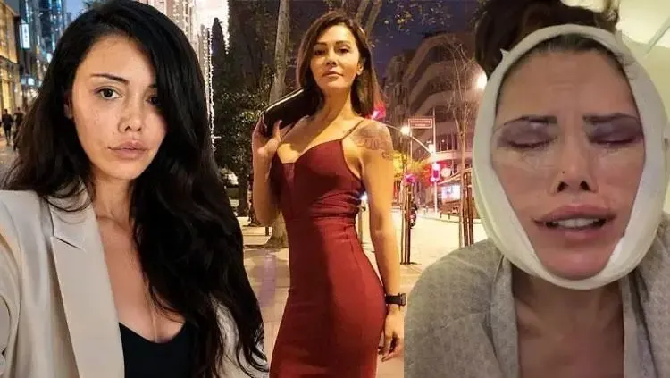 Yüz nakli olmuştu: 'CİMER' detayını gözyaşlarıyla anlattı
