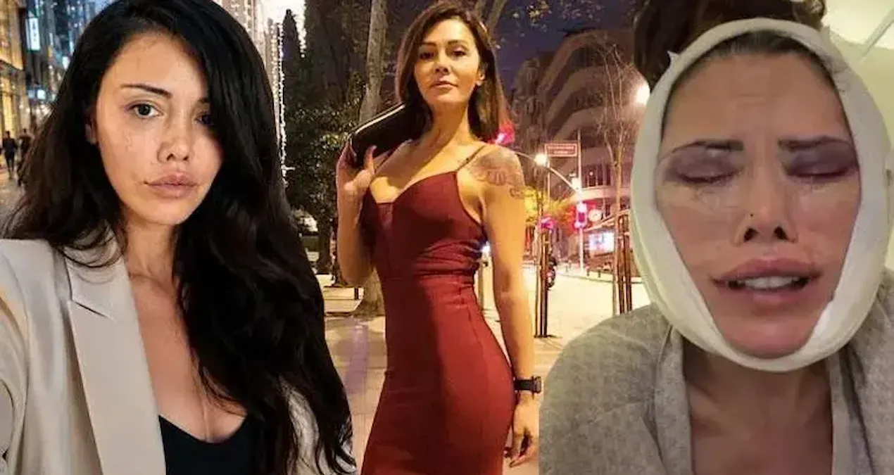 Yüz nakli yaptıran Didem Ceran gözyaşlarıyla anlattı: Beni şikayet ediyorlar!