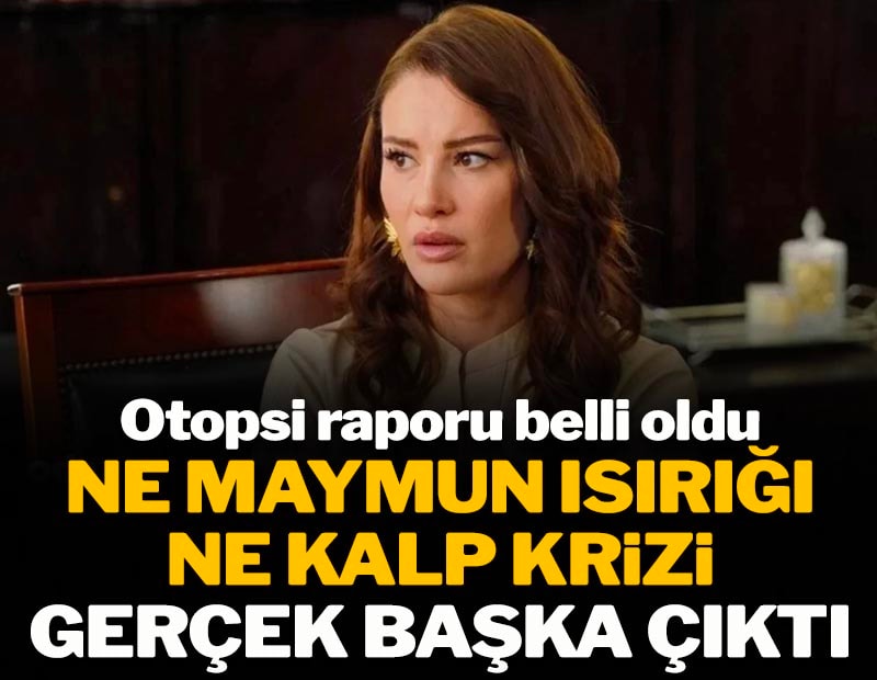 Maymun ısırığı deniyordu gerçek başka çıktı: Ünlü Oyuncu Ece İrtem'in ölüm sebebi belli oldu