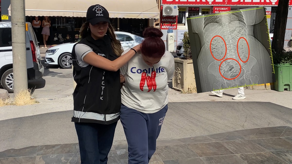 Midesinden çıktı, hemen gözaltına alındı