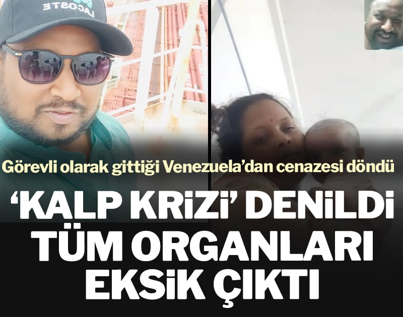 Venezuela’da kalp krizinden öldü denilen adamın tüm organları eksik çıktı
