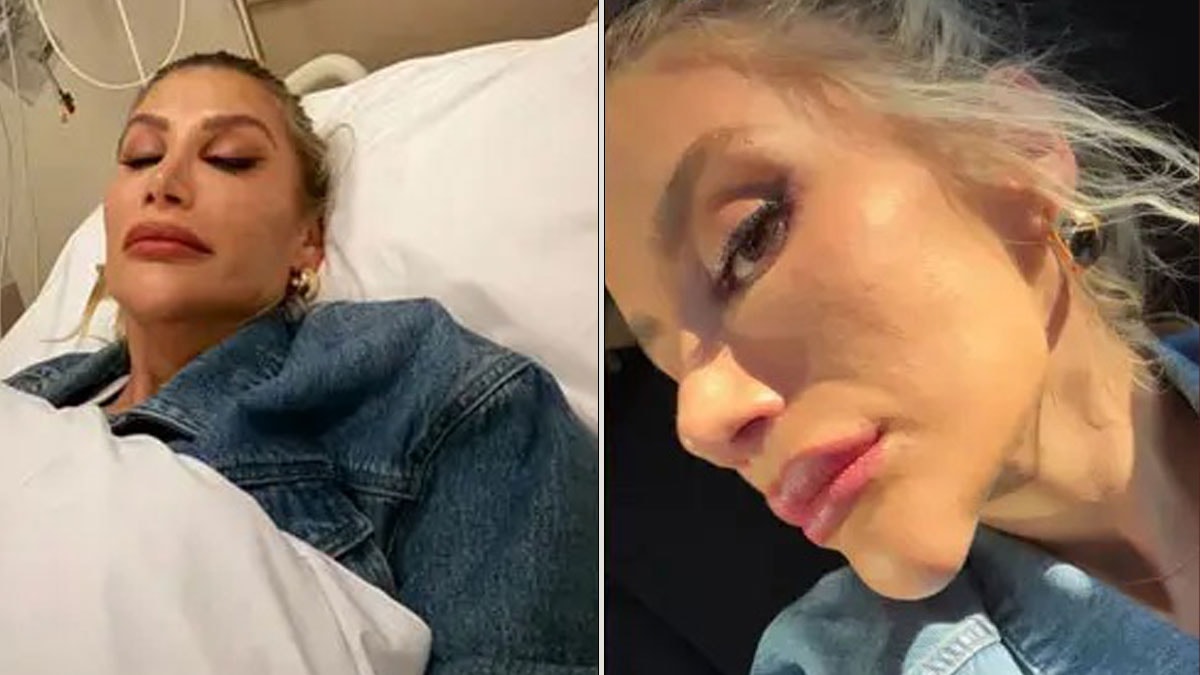 İrem Derici'nin talihsiz anı: Çenesi dakikalar içerisinde bu hale geldi