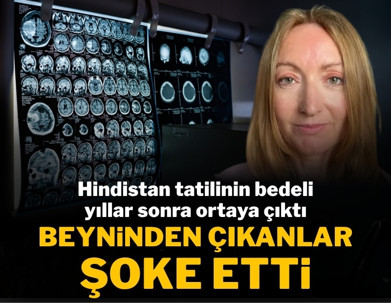 Hindistan tatilinin bedeli ağır oldu: Beyninde 38 parazit çıktı