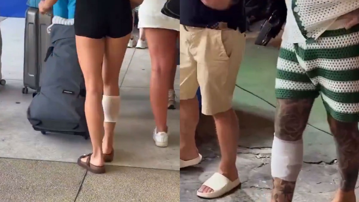Bu ülkeye gidenlerin hepsinin sağ bacağında aynı iz var 