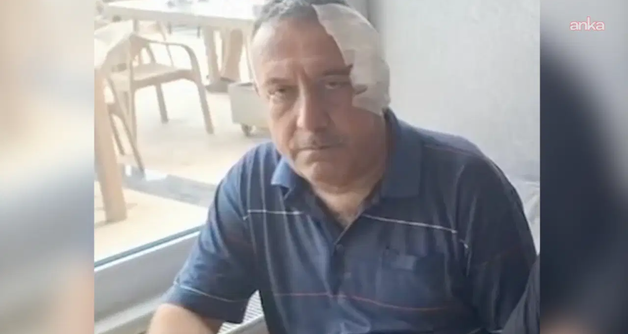 Sinop'ta Aşı Takibi Yapan Sağlık Memuruna Yumruklu Saldırı