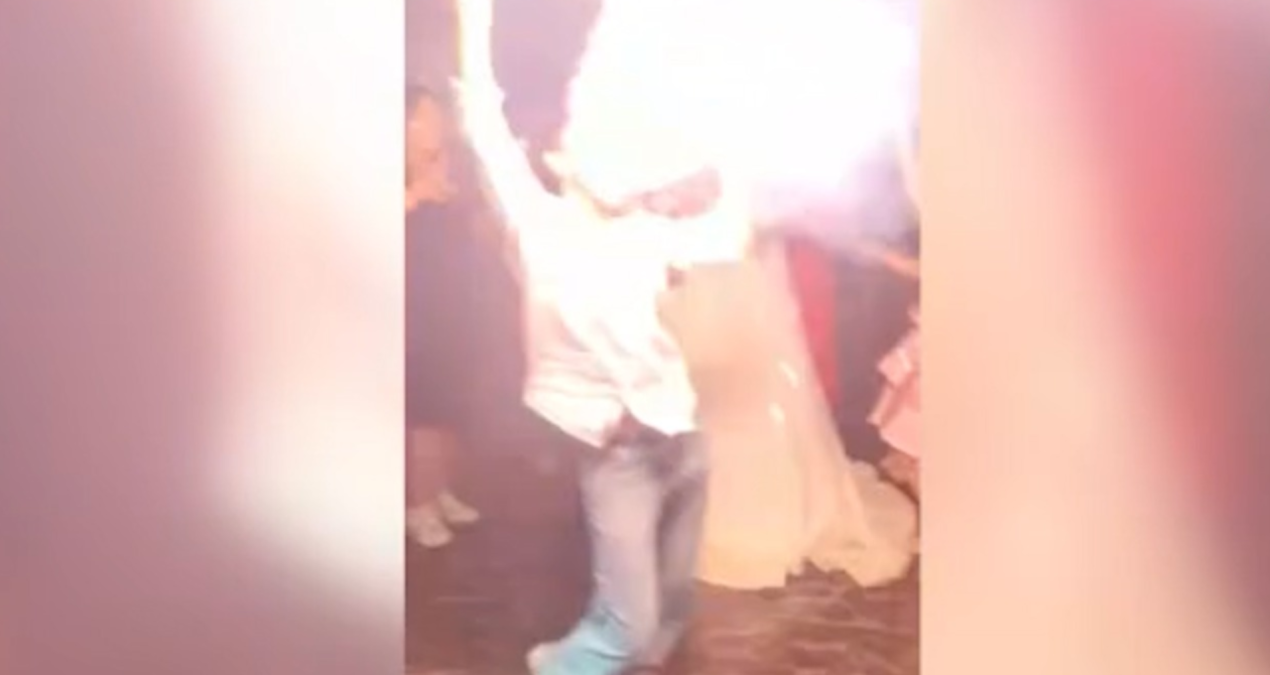 Gelin ve damadın yanında dehşeti yaşadı: Ağzına koyduğu meşale yüzünde patladı!