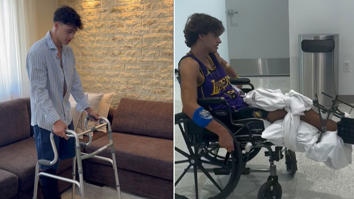 Survivor'da bacağını kaybeden yarışmacı yeni hayatına alışmaya çalışıyor: Yürütece başladı