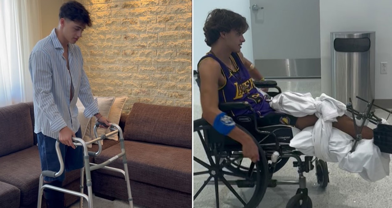 Survivor'da bacağını kaybeden yarışmacı yeni hayatına alışmaya çalışıyor: Yürütece başladı