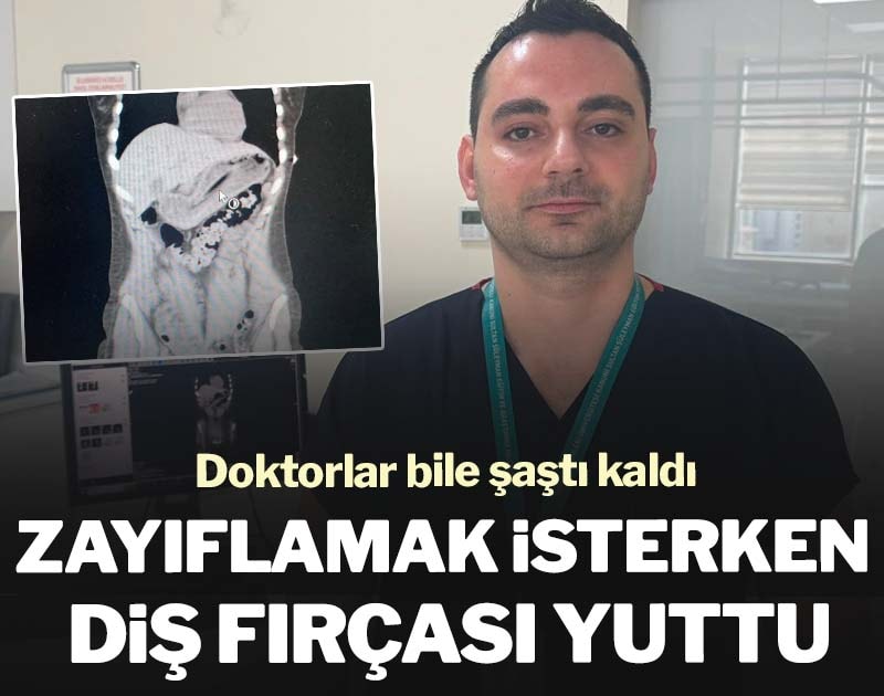 Zayıflamak isterken 13 santimetrelik diş fırçası yuttu: Doktorlar bile şaştı kaldı
