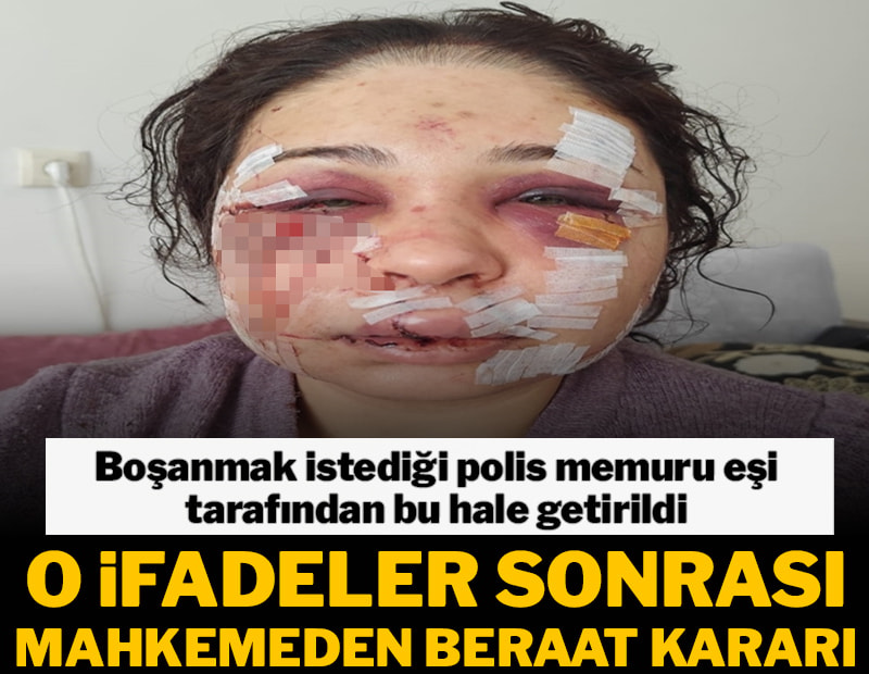 Boşanma sürecindeki eşini darbeden polis memuru o ifadeler sonrası tahliye edildi