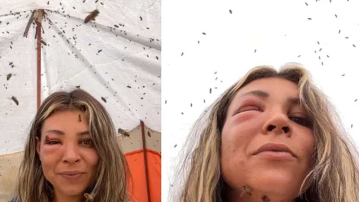 Arılarıyla yakın bağ kurmak istedi: Yüzü tanınmaz hale geldi