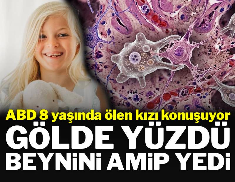 ABD bu kızı konuşuyor: Gölde yüzdü, beynini amip yedi