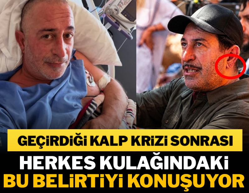Cem Yılmaz'ın kalp krizi sonrası herkes kulak memesindeki detayı konuşuyor