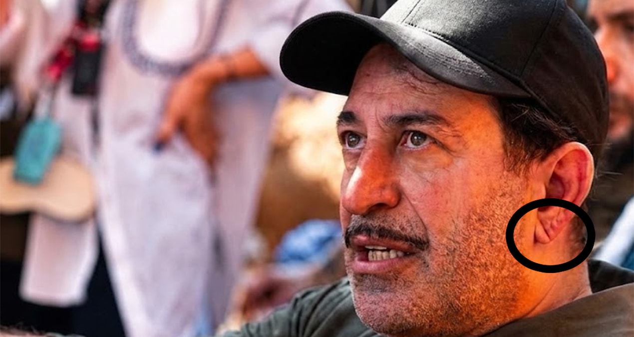 Cem Yılmaz'ın Kalp Krizi Sonrası Dikkat Çeken Detaylar