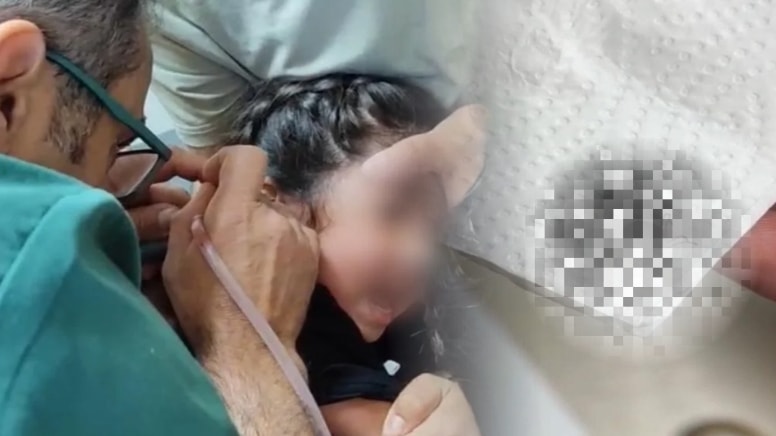 Haftalardır ağrı çekiyordu! Kulağından canlı canlı çıkarıldı
