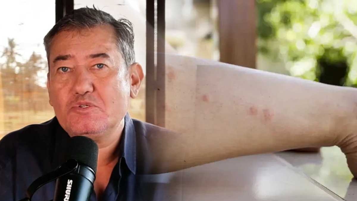 Dang virüsü ölümcül müdür, Gazeteci Serdar Akinan'ın yakalandığı Dang Humması tam olarak nedir?