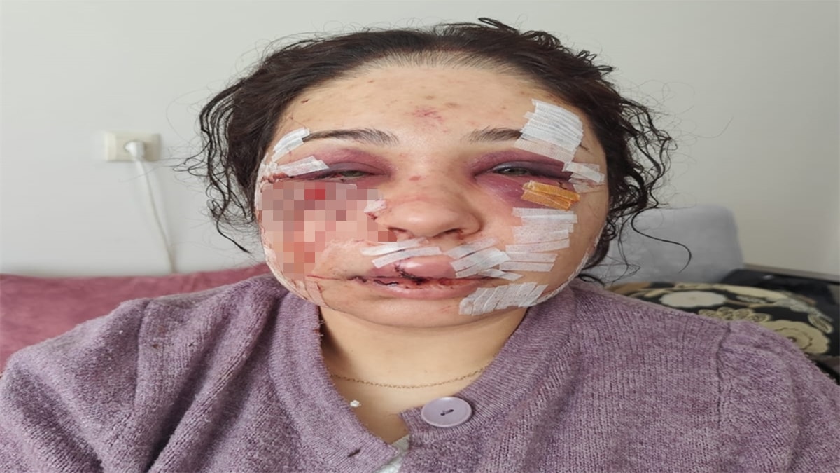 Boşanma sürecindeki eşini darbeden polis memuru tahliye edildi