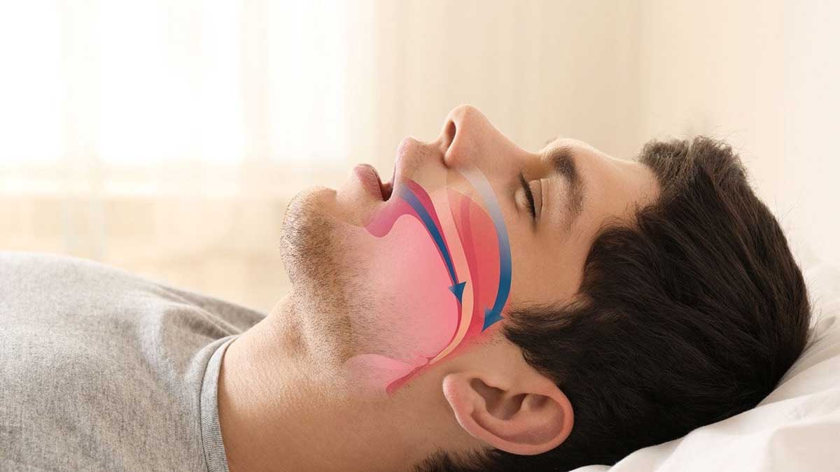 Gece horlayanları tek seferde susturacak formül bulundu