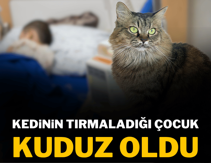 Kedinin tırmaladığı çocuk kuduz oldu