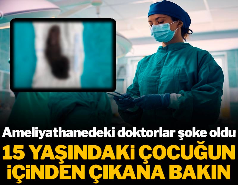 15 Yaşındaki Çocuğun İçinden Çıkanlar Doktorları Bile Şoke Etti