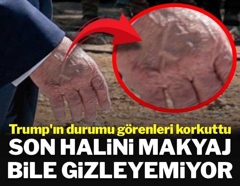 Trump'ın durumu görenleri korkuttu: Son halini makyajla bile gizleyemiyor