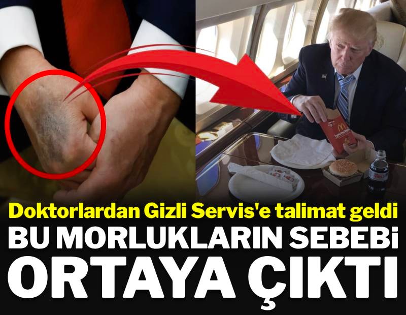 Doktorlardan Gizli Servis'e talimat geldi: Bu morlukların sebebi ortaya çıktı