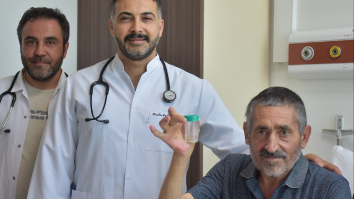 Şifa niyetine yuttu, kabusu yaşadı! Doktorların bile ağzı açık kaldı