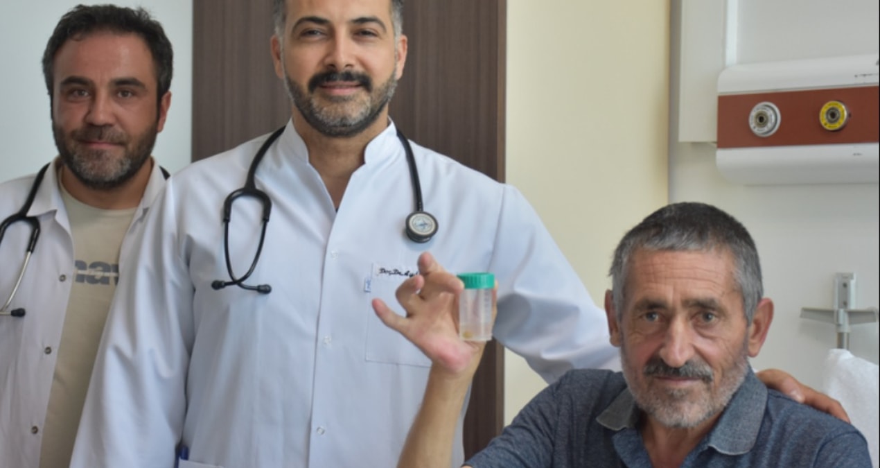 Şifa Niyetiyle Yuttuğu Sarımsak Ciğerine Kaçtı: 6 Ay Sonra Akciğerinden Çıkarıldı