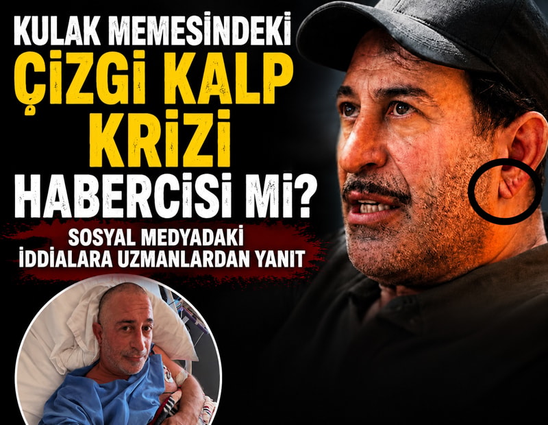 Kulak memesindeki çizgi kalp krizi habercisi mi? Sosyal medyadaki iddialara uzmanlardan yanıt