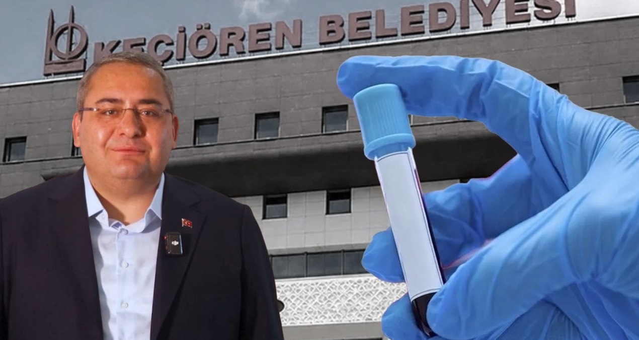 Keçiören Belediye Başkanı yaptıklarına pişman oldu! Uyuşturucu testi yaptırdı, sonuçlar ortalığı karıştırdı