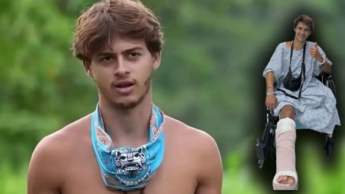 Survivor'da bacağı koptu: Milyon dolarlık dava açtı