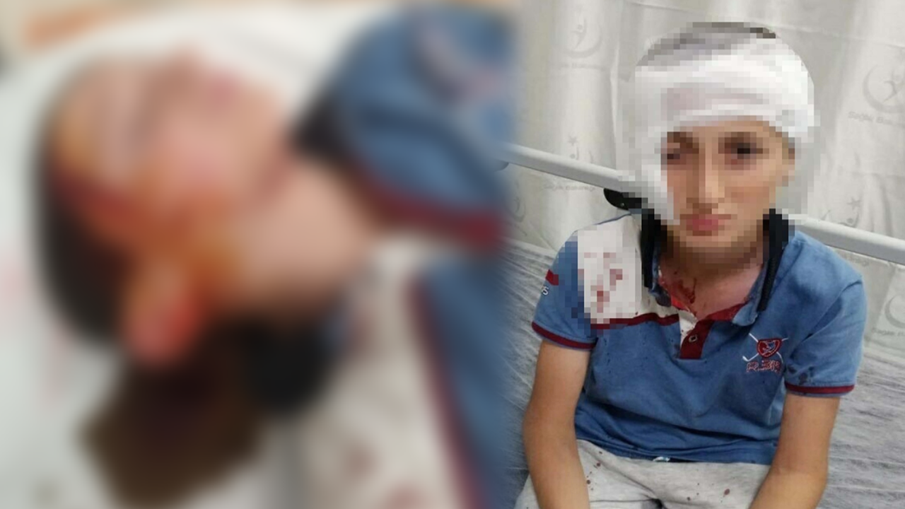 11 yaşındaki çocuğa köpek saldırısında 1,2 milyon TL tazminat